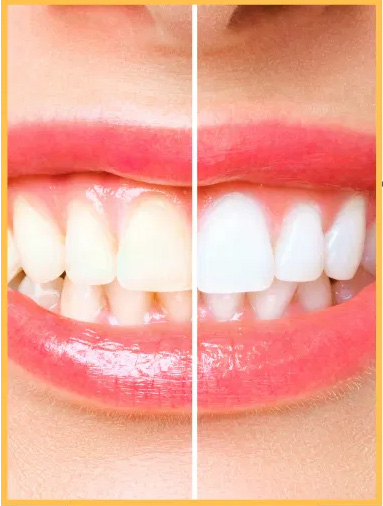 Identical Dental | Implant Dentistry, Oral Exams and Emergency Treatment