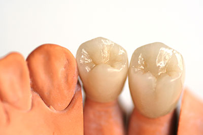 Identical Dental | Pediatric Dentistry, TMJ Disorders and Oral Cancer Screening