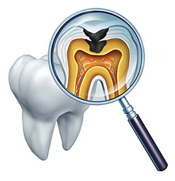 Identical Dental | ZOOM  Whitening, Dental Bridges and Root Canals