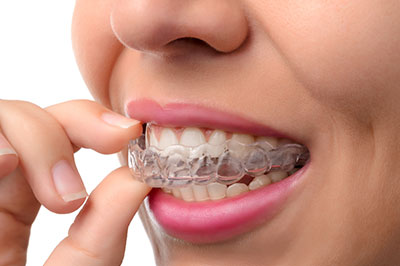 Identical Dental | Dental Cleanings, Dental Sealants and Dental Bridges