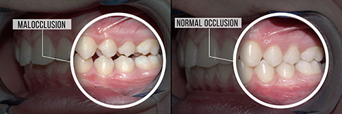 Identical Dental | Dental Bridges, Dental Fillings and Oral Exams