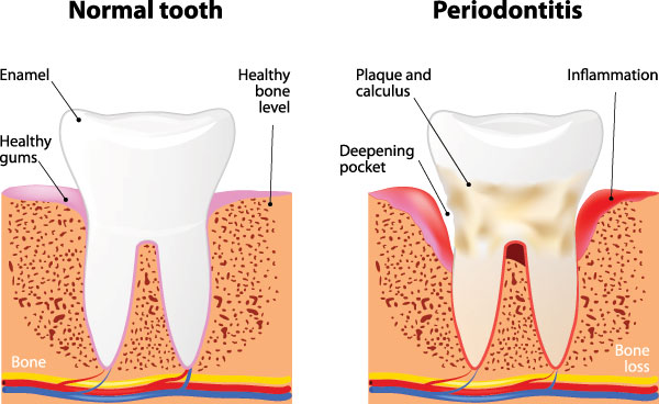 Identical Dental | Teeth Whitening, Dental Cleanings and Bone Grafts