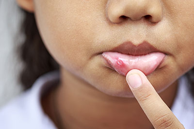 Identical Dental | Veneers, Bone Grafts and Pediatric Dentistry