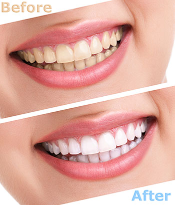 Identical Dental | Oral Exams, Dentures and TMJ Disorders