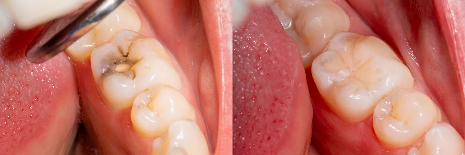 Identical Dental