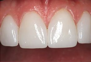 Identical Dental | Cosmetic Dentistry, Dental Fillings and Extractions